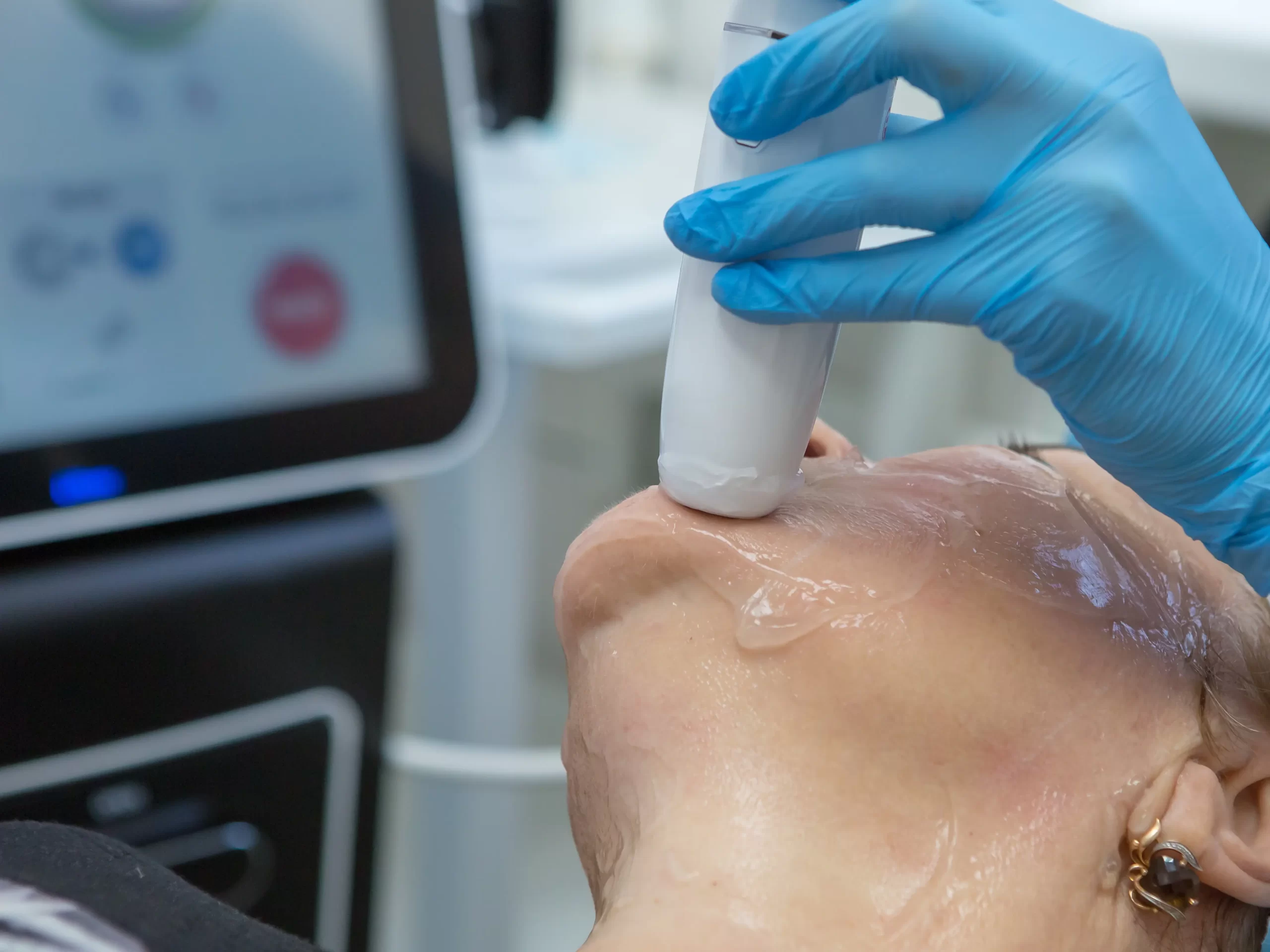 Medicina Estetica Yesica Sosa En Canarias